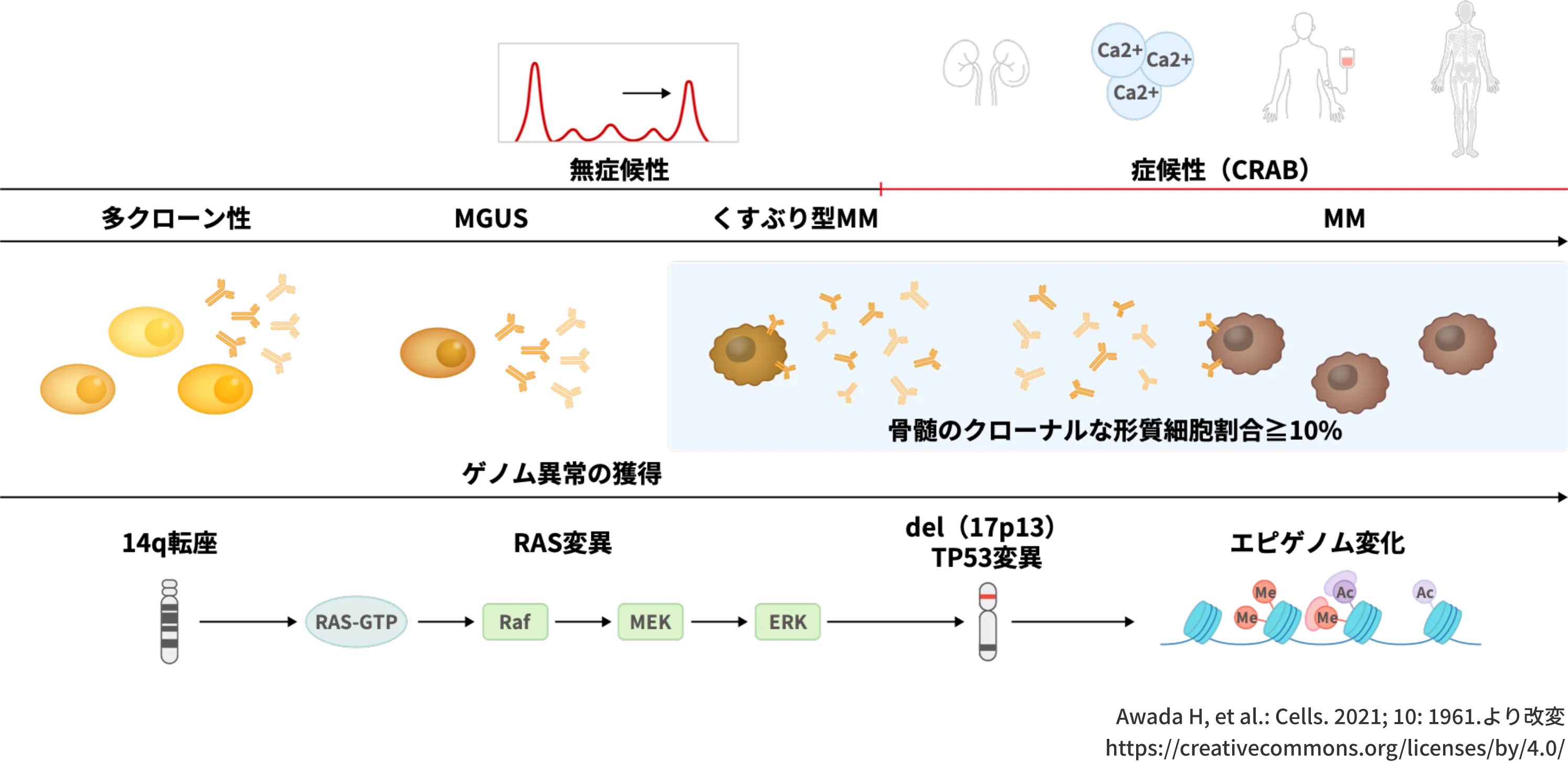 腫瘍免疫微小環境（TiME） | IBTシリーズ 新たな治療概念：多発